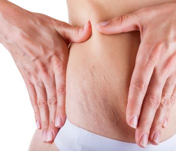 Sagging Skin Treatments from doctor in Lake Oswego