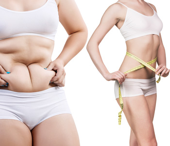Collage of female body before and after weight loss over white background